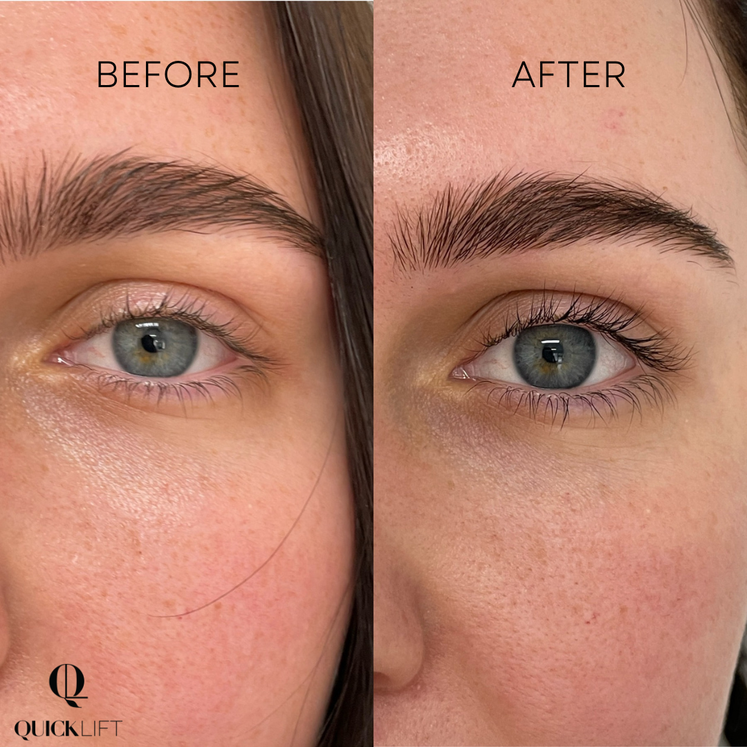 Lash & Brow Growth Serum