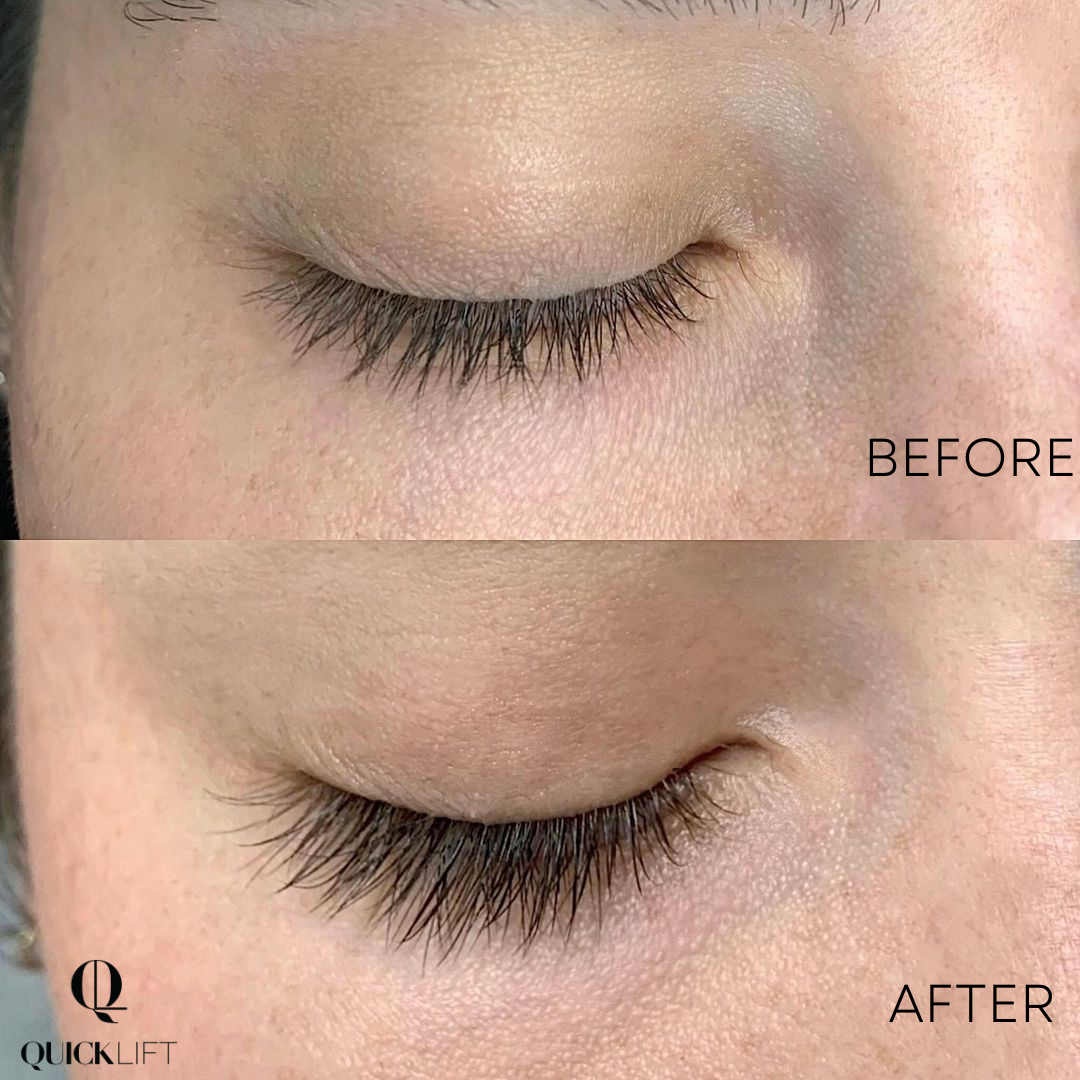 Lash & Brow Growth Serum