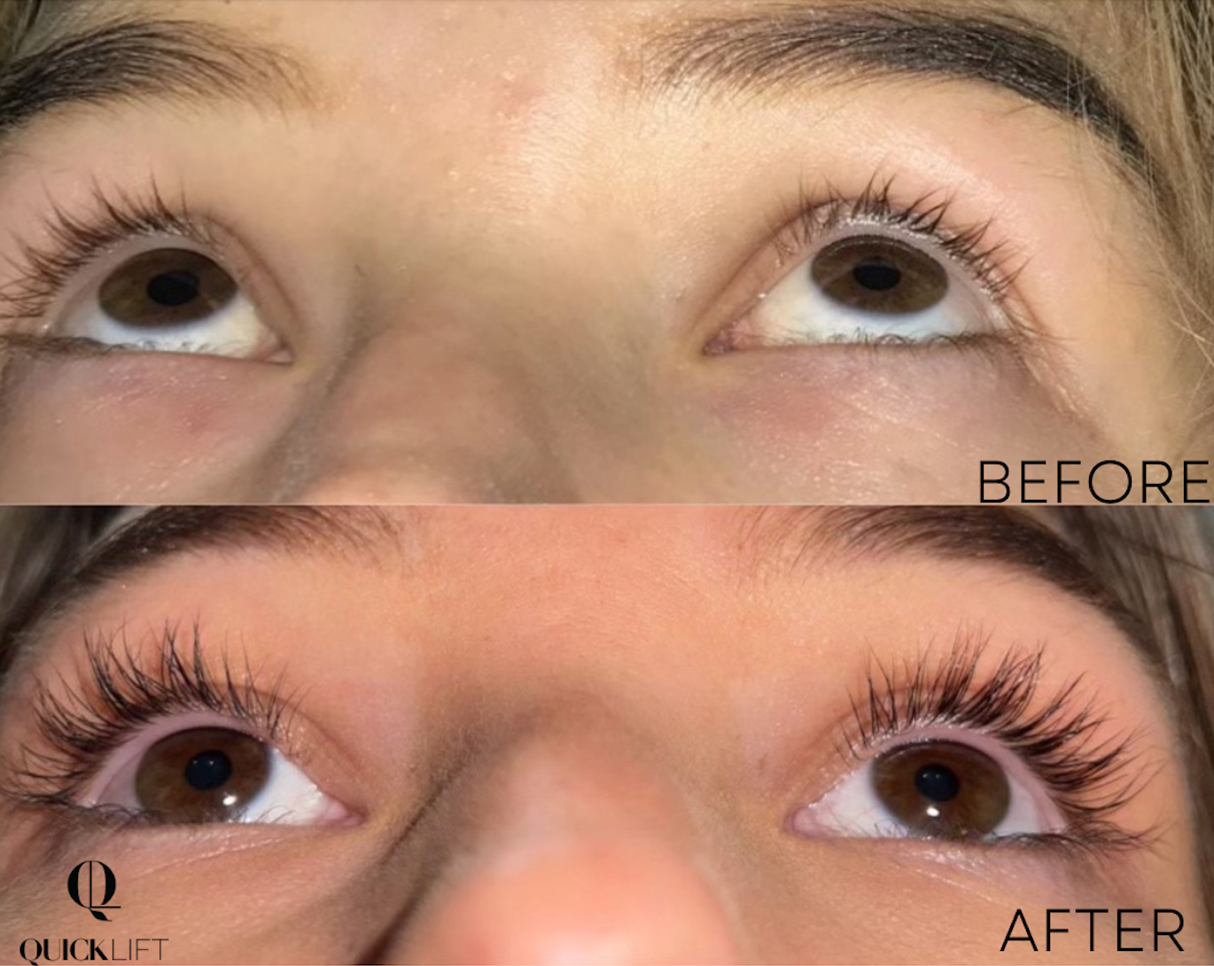 Lash & Brow Growth Serum